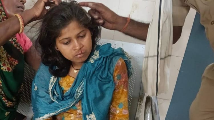 Bahraich:खेत गई युवती पर तेंदुए का हमला, चीख सुनकर लोग दौड़े तब बची जान; गंभीर हालत में अस्पताल में भर्ती – Leopard Attacks Young Woman In Field In Bahraich Has Been Admitted To Hospital In Serious Condition