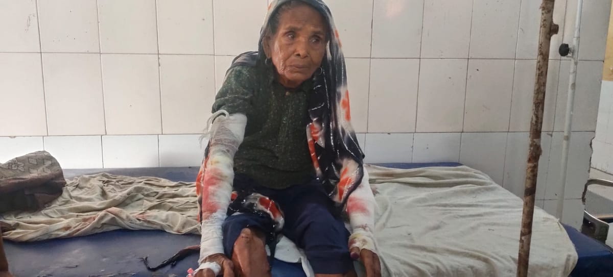 Bahraich:आंगन में सो रही 80 वर्षीय वृद्धा पर तेंदुए का हमला, दोनों हाथ नोचे डाले, गहरे जख्म दिए – Bahraich: Leopard Attacks 80-year-old Woman Sleeping In Courtyard; Mauls Both Her Hands.