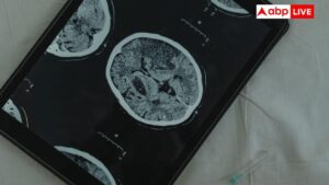 Brain Stroke: सोते-सोते कैसे आ जाता है स्ट्रोक, इन लक्षणों को कभी न करें नजरअंदाज