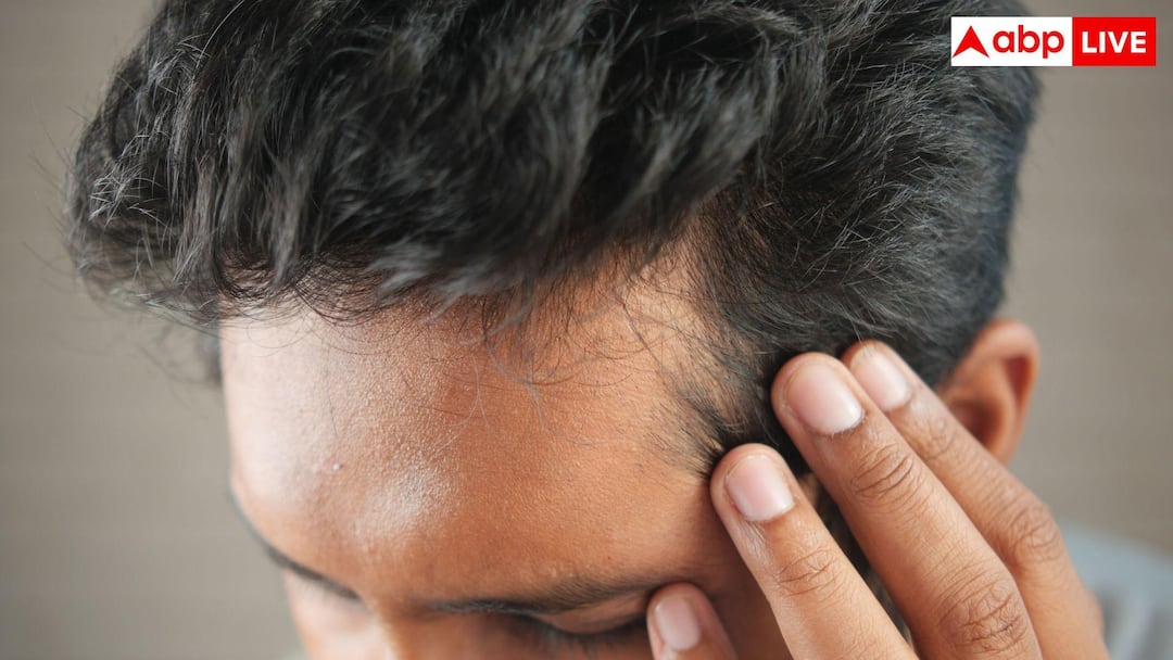 हेयर ट्रांसप्लांट का कर रहे हैं विचार? जानिए क्या हैं इसके साइड इफेक्ट्स